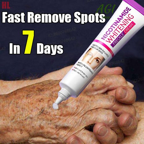 Face Skin Care Set Nicotinamide Whitening Freckles Cream + Facial Cleanser + Moisturizing lotion + Face Essence + Face Toner + Masks 5 Pcs Remove Melasma Dark Spot Acne Marks Brightening Skin Tone