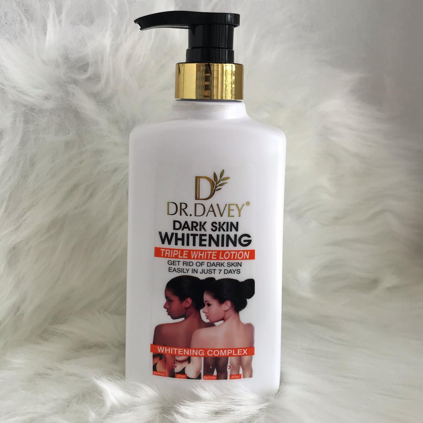 DR.DAVEY Fast Skin Whitening Body Lotion For Hand And Face,Moisturizing Body Cream Glows and Brightens Moisturizes and Hydrates Treats Acne and Spots Evens Skin Tone