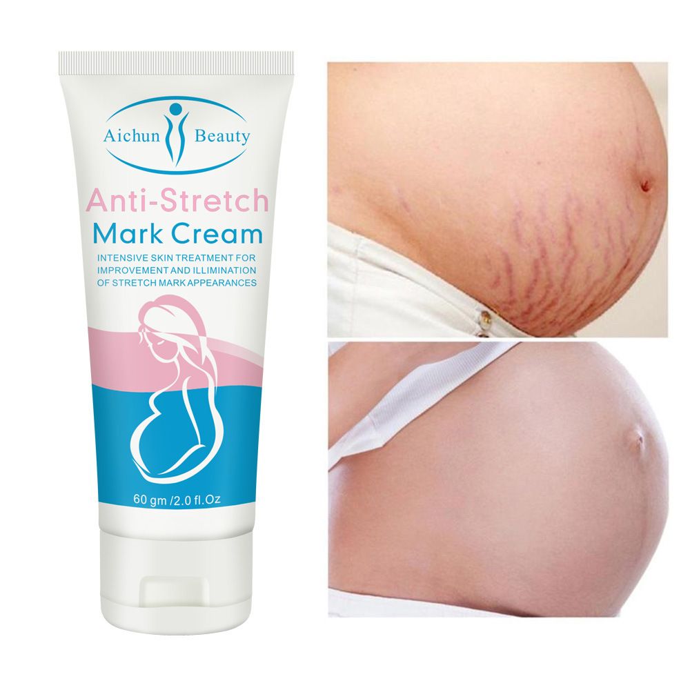 Removes Stretch Mark Cream To Remove Postpartum Obesity Pregnant Women Repair Anti-Aging Anti-Wrinkles Firming Body Cream
