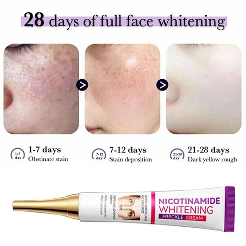 Face Skin Care Set Nicotinamide Whitening Freckles Cream + Facial Cleanser + Moisturizing lotion + Face Essence + Face Toner + Masks 5 Pcs Remove Melasma Dark Spot Acne Marks Brightening Skin Tone
