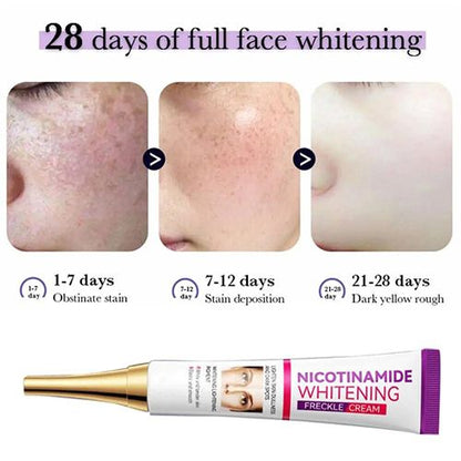 Face Skin Care Set Nicotinamide Whitening Freckles Cream + Facial Cleanser + Moisturizing lotion + Face Essence + Face Toner + Masks 5 Pcs Remove Melasma Dark Spot Acne Marks Brightening Skin Tone