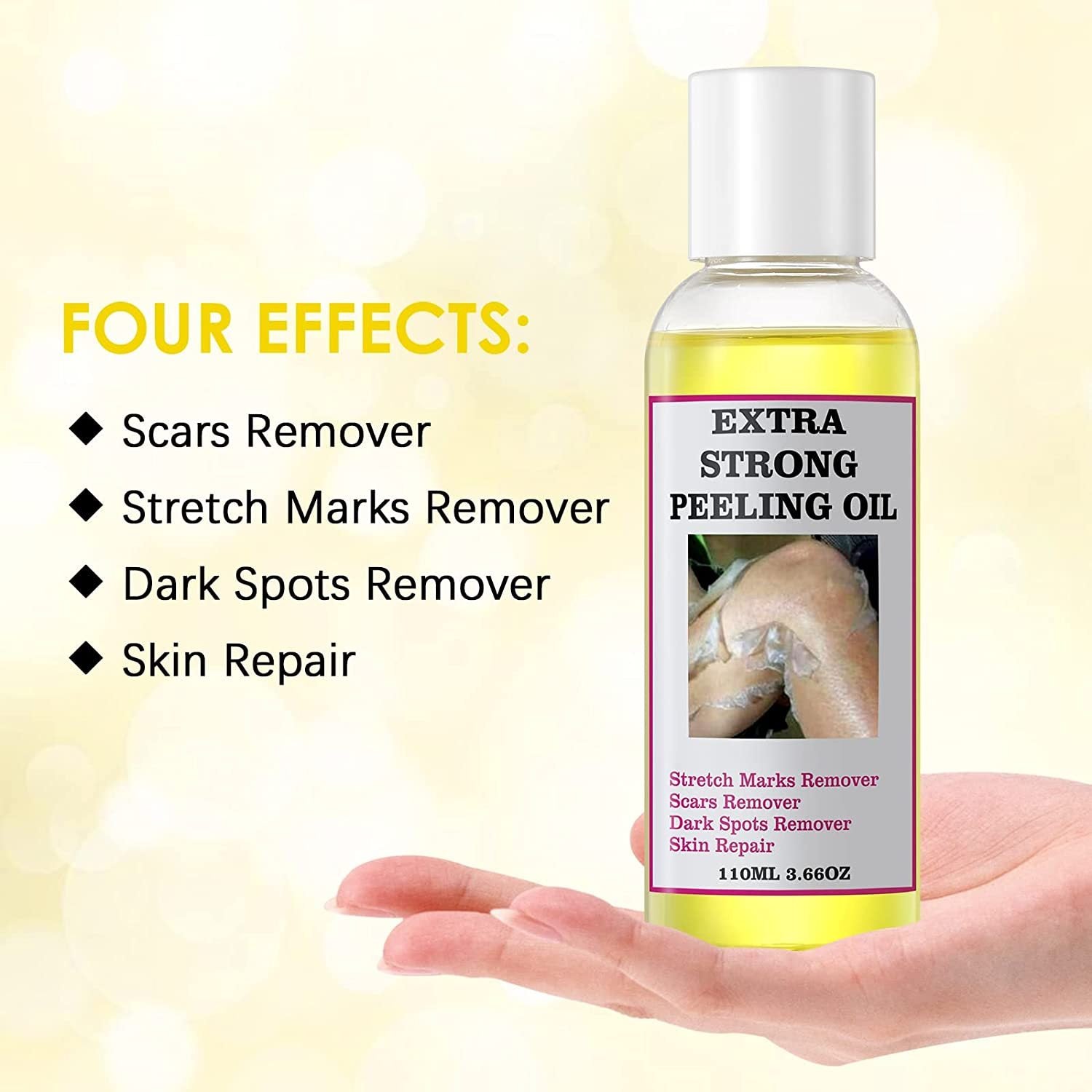 Extra Strong Yellow Peeling Oil Whitening Peeling Oil Skin Care Lighten Elbows Knees Hands Melanin Even Skin Tone and Whiten Skin