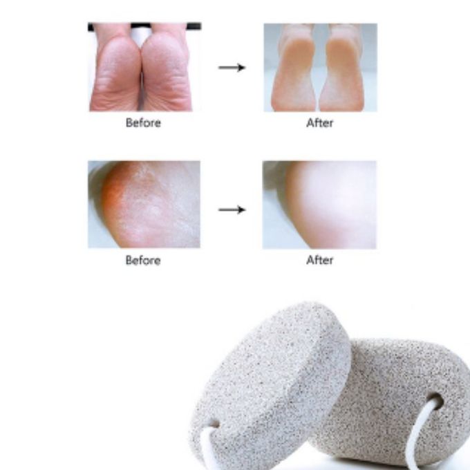 2Pcs Pumice Stone For Feet Scrub & Exfoliating Dead Dry Skin Callus Remover Hands Scrubber