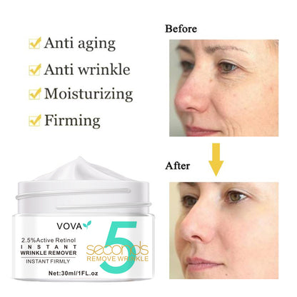 VOVA 5 Seconds Instant Wrinkles Removal Cream Active Retinol Lifting Firming Anti-aging Improve Fade Fine Lines Face Moisturizing Skin Care