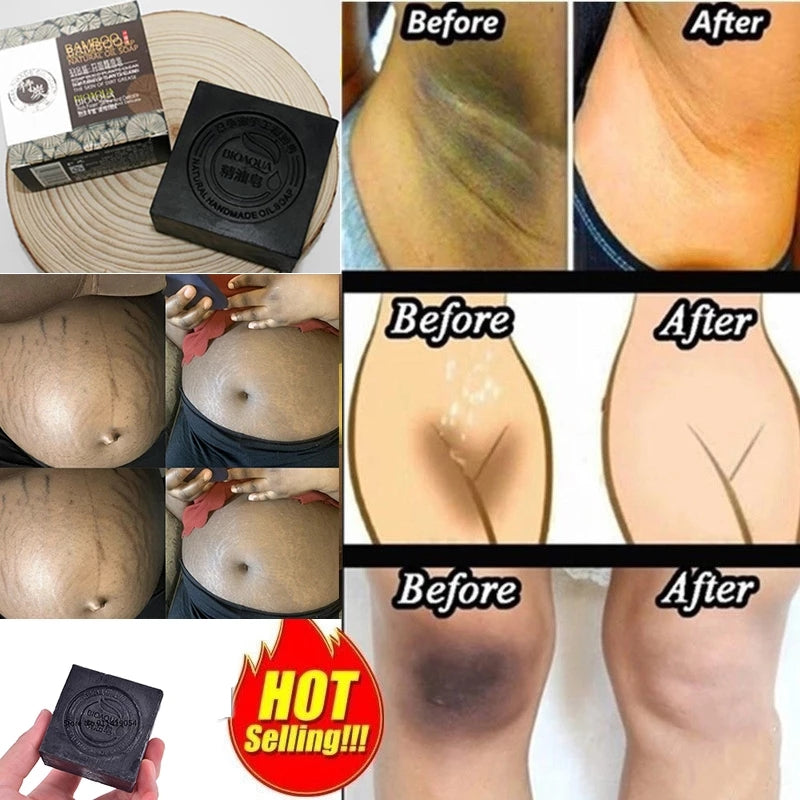 Natural Organic Herbal Essential Black Bamboo Oil Soap Whitening Handmade Soap Skin Remove Acne Deep Cleansing Anti Bacterial