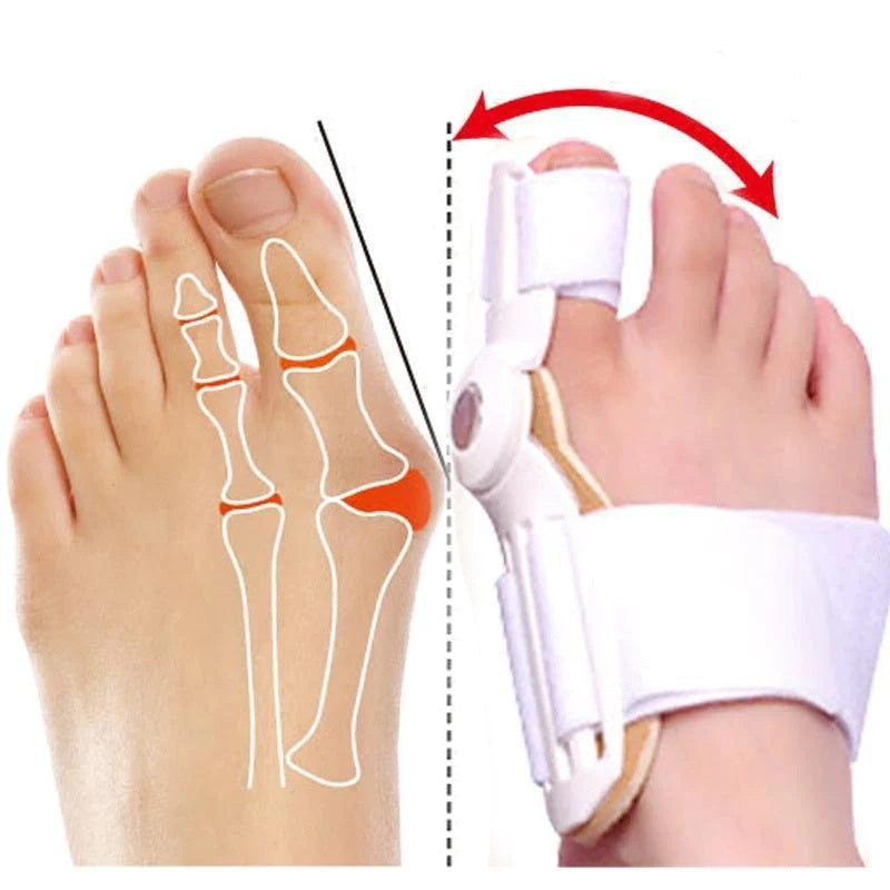 Orthopedic Bunion Corrector 1 PCS Hallux Valgus Brace Splint Pads Bunion Big Toe Separators Straightener Universal for Left and Right Feet