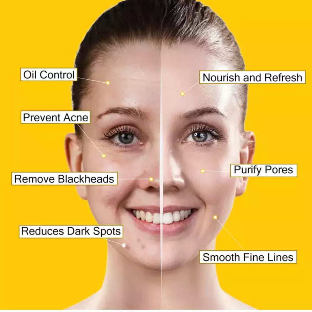 Turmeric Clay Mask - Detox, Anti-acne, Repair, Anti-aging, Remove Blackheads, Moisturizing Skin