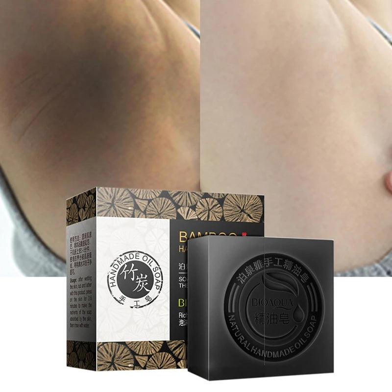 Natural Organic Herbal Essential Black Bamboo Oil Soap Whitening Handmade Soap Skin Remove Acne Deep Cleansing Anti Bacterial