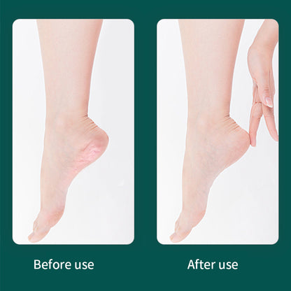 10Pcs Professional Pedicure Tools Set Foot Care Kit Stainless Steel Foot Rasp Foot Dead Skin Remover Callus Clean Feet Care