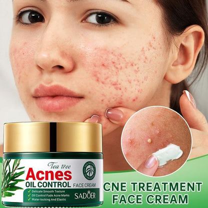 SADOER Tea Tree Acnes Oil Control Face Cream with Tea Tree Extract. Heals Acne, Fades ACNE Marks, Soothes, Repairs, Moisturizes, Makes skin elastic