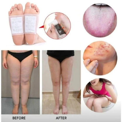 10pcs/box Detox Foot Patches, Foot Pads Toxins Remover Cleansing Detox Foot Patches, Feet Slimming Cleansing Herbal Body Health For Weight Loss, Detox Foot Patch Natural Improve Sleep Foot Body Care