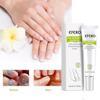 EFERO Nail Treatment Repair Cream Toe Be Health Instant Beauty Gel Cure Damaged Foot & Toenails Restores Appearance of Discolored or Damaged Nails