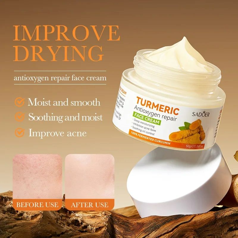 SADOER Turmeric Antioxygen Repair Face Cream Deep Hydration Improve Acne Soothing Oil Control Moisturizing Delicate Smooth Facial Skin Care