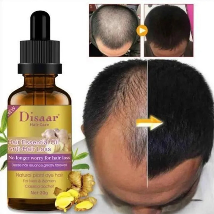 Disaar Hair Growth In Baldness Essential Oil -Anti Hair Loss