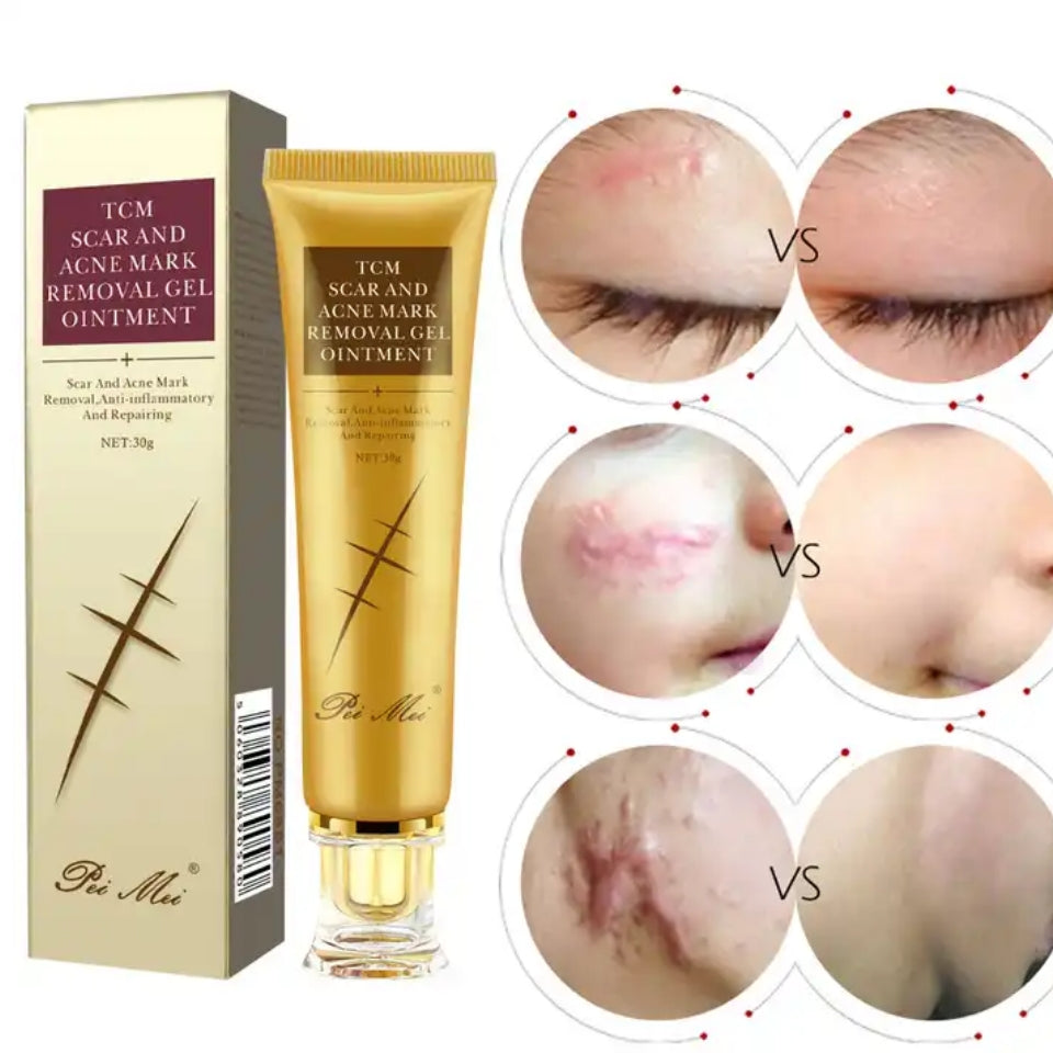 TCM Scar And Acne Mark Removal Gel Ointment Repairing Cream - Pei Mei
