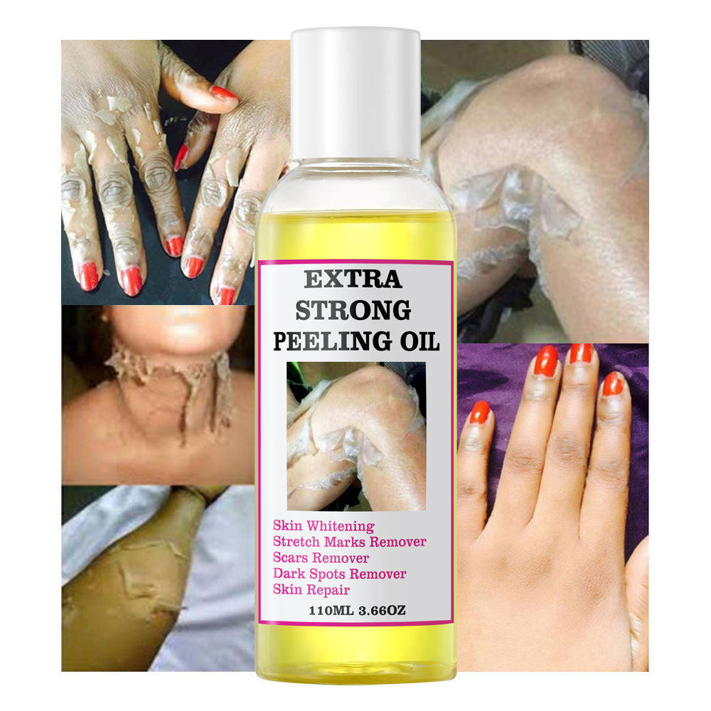Extra Strong Yellow Peeling Oil Whitening Peeling Oil Skin Care Lighten Elbows Knees Hands Melanin Even Skin Tone and Whiten Skin