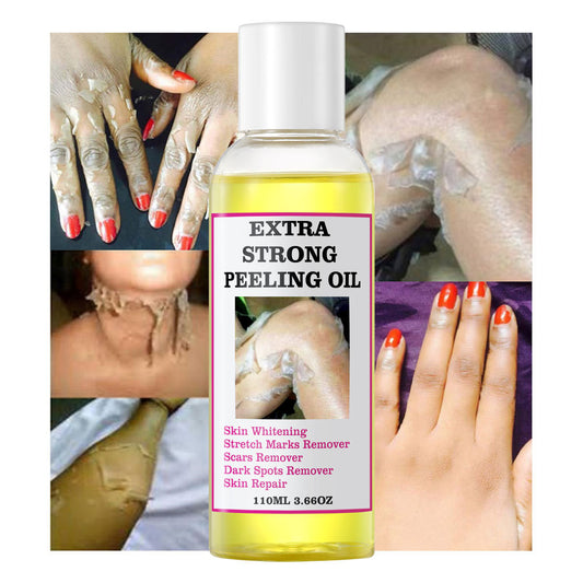 Extra Strong Yellow Peeling Oil Whitening Peeling Oil Skin Care Lighten Elbows Knees Hands Melanin Even Skin Tone and Whiten Skin