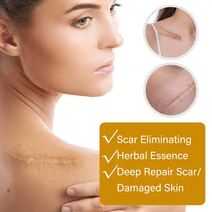 Removal Scar Ultra Premium Compound Essential Oil - Vitalizes Skin Cells Counteracts Aging Repair Scars Remover - Aichun Beauty
