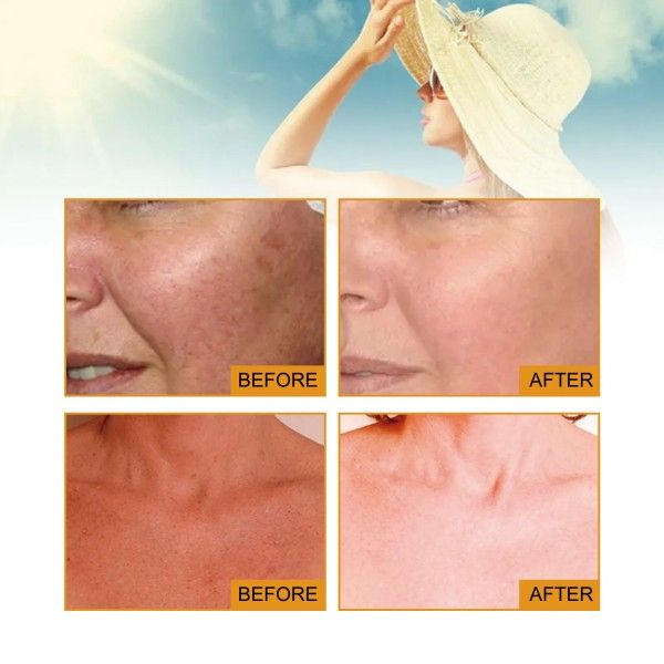 Spf50+ Facial Sunscreens Rapid Film Forming Oil Control Refreshing Anti-Acne Sunscreen