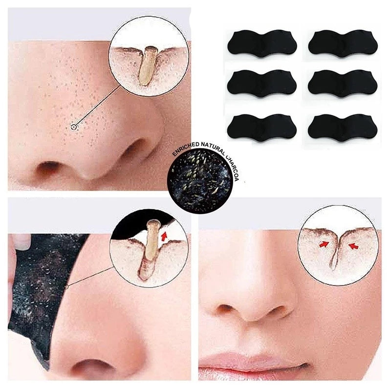 8pcs/4pcs set Blackhead Comedone Acne Pimple Blemish Extractor Vacuum Blackhead Remover Tool Spoon for Face Skin Care Tool