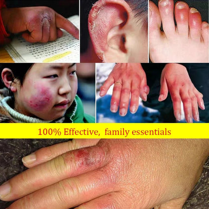 85g Anti Crack Foot Cream Dryness Foot Mask Heel Cracked Repair Cream Hand Mositurizing Removal Callus Dead Skin Hands Feet Care 4.5