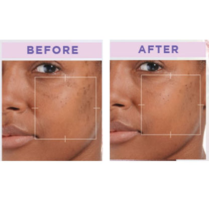 【Clearance Sale】L'Oreal Paris GlycolicBright Acid Serum 30ml