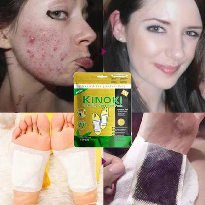 10pcs/box Detox Foot Patches, Foot Pads Toxins Remover Cleansing Detox Foot Patches, Feet Slimming Cleansing Herbal Body Health For Weight Loss, Detox Foot Patch Natural Improve Sleep Foot Body Care