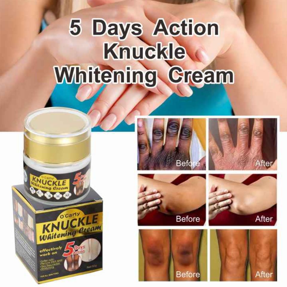 O'Carly Knuckle Whitening Cream. Clears Dark Knuckles Spots Ocarly