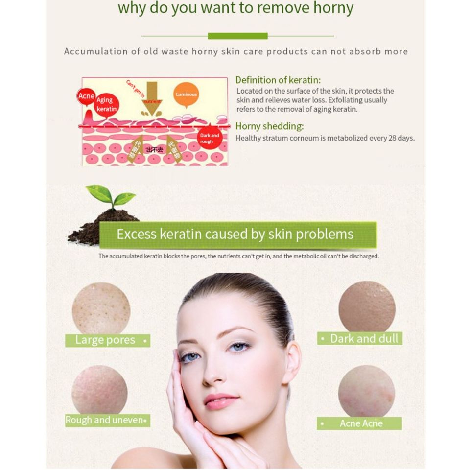 Aroma Peeling Gel Removing Dead skin cells and waste in pores and brightening skin Controlling Sebum Remove blackheads Brightening skin - Yan Namei Ji