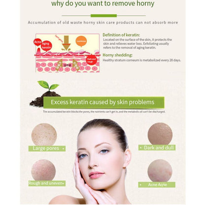 Aroma Peeling Gel Removing Dead skin cells and waste in pores and brightening skin Controlling Sebum Remove blackheads Brightening skin - Yan Namei Ji