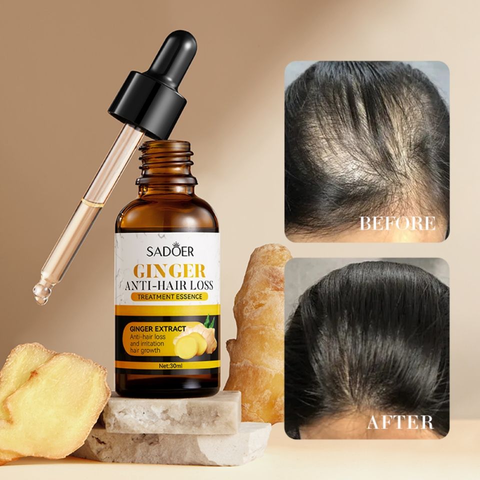 Hair Growth Oil Serum Sadoer Ginger Essence Hair Care Serum Hair Softening and Hair Moisturizer for best hair growth results Anti Hair Loss Treatment Essence 30ml