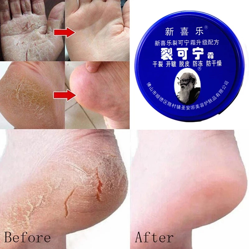 85g Anti Crack Foot Cream Dryness Foot Mask Heel Cracked Repair Cream Hand Mositurizing Removal Callus Dead Skin Hands Feet Care 4.5