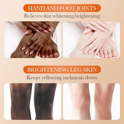 Sadoer Dark Knuckle Whitening Cream Skin Body Bleaching For Dark Knees and Elbows,Moisturizing Strong Joint Whitening Cream for Clavicle,Neck,Niacinamide Vitamin C Dark Spot Corrector Remover