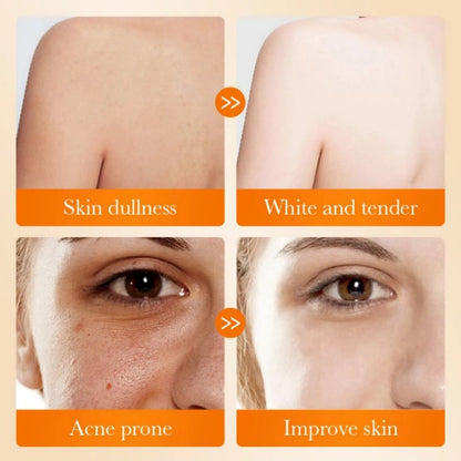 2 PIECES Sadoer Kojic Soap, Kojic Acid Whitening Soap, Deep Cleansing, Skin Brightening Like Vitamin C, Improve Acne Prone Skin, For Face and Body Skin Care