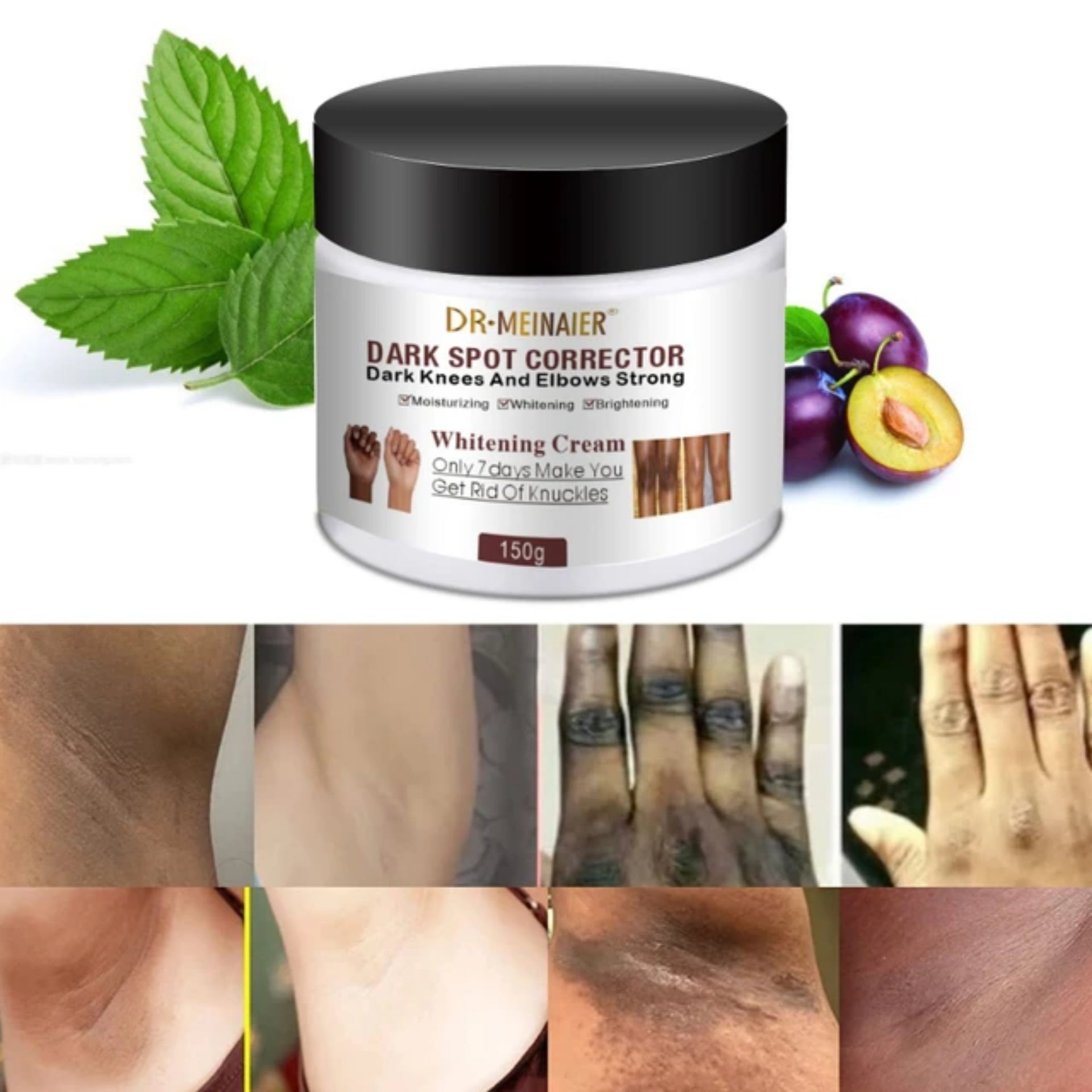 Dr. Meinaier Dark Spot Corrector Cream Whitening Brightening Knuckles Clears Spots Underarm knees & elbow