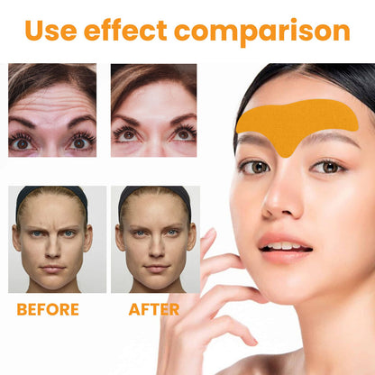 Anti-wrinkle Forehead patch，smoothing and diminishing forehead wrinkles, and tightening facial skin