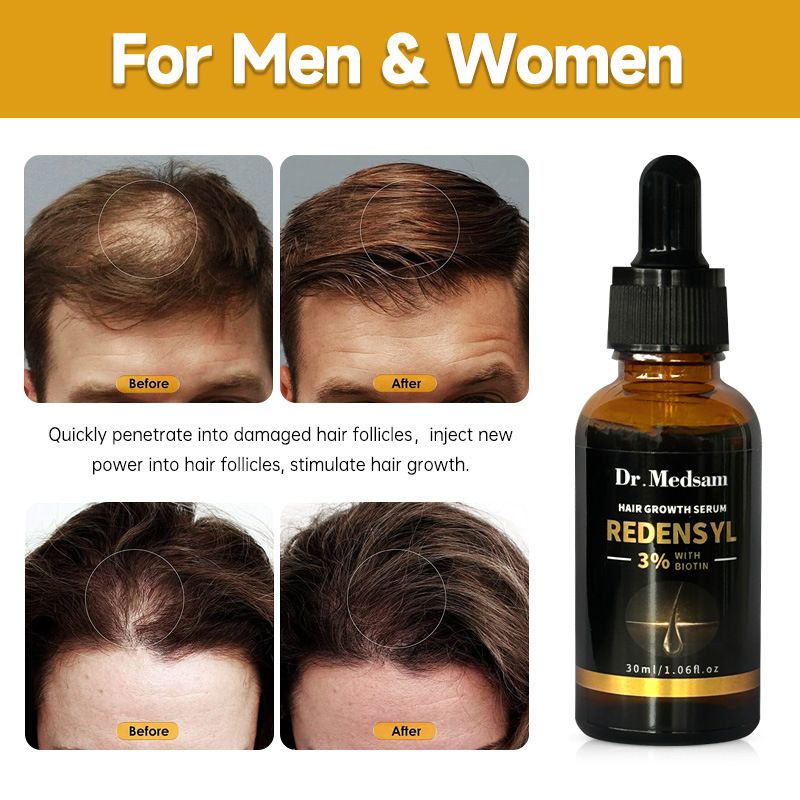 Castor oil Biotin Hair Growth Solution Hair Growth Rosemary Hair Essence Hair Care Loss Products