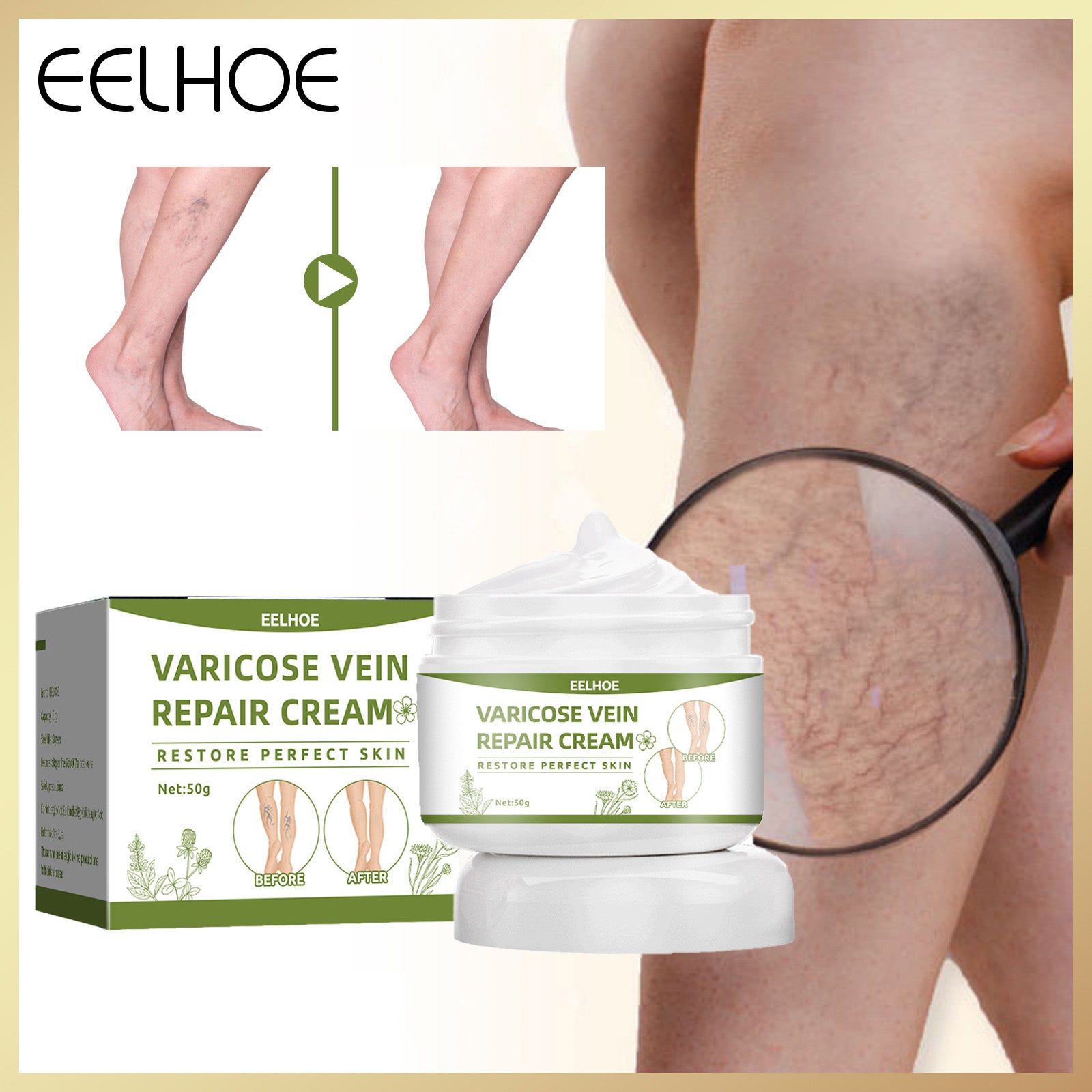 Varicose Veins Repair Cream Spider Varicose Vein Treatment Cream Vein Healing Ointment Improving Blood Circulation Leg Repair Gel