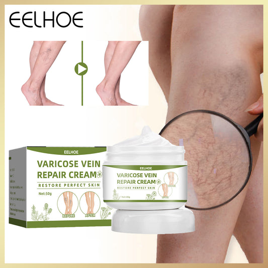 Varicose Veins Repair Cream Spider Varicose Vein Treatment Cream Vein Healing Ointment Improving Blood Circulation Leg Repair Gel
