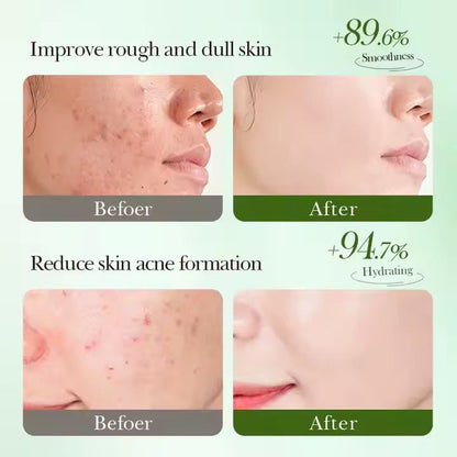 SADOER Salicylic Acid Anti Acne Soothing Repair Hydrating Mask Wholesale Price SADOER Salicylic Acid Acne Removing Soothing Repairing Moisturizing Face Mask