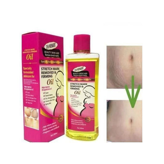 Stretch Mark Removed & Firming Oil- 200ml.