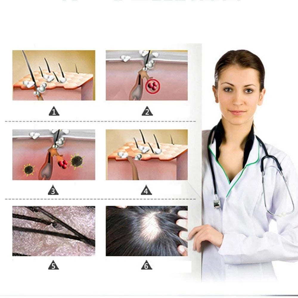 30MLGinger Hair Growth Serum Essence Liquid Prevent Hair Loss Repair Damaged Hair Natural Hair Care Ginger Germinal Oil