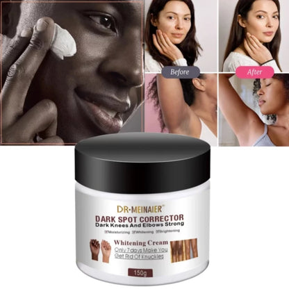 Dr. Meinaier Dark Spot Corrector Cream Whitening Brightening Knuckles Clears Spots Underarm knees & elbow