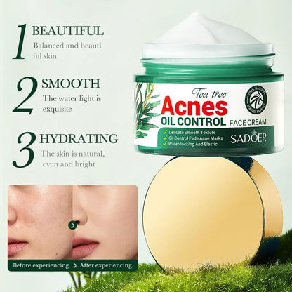 SADOER Tea Tree Acnes Oil Control Face Cream with Tea Tree Extract. Heals Acne, Fades ACNE Marks, Soothes, Repairs, Moisturizes, Makes skin elastic