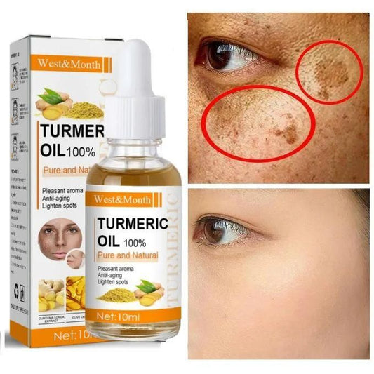 Tumeric Anti Oxidation Face Serum Acne Remover Skin Lightening Serum