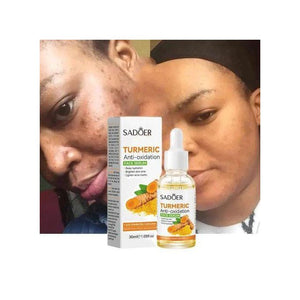 Turmeric Anti-Oxidation + Soothing Care + Brightening Skin Tone + Deep Dehydration + Acne + Dark Spots Face Serum