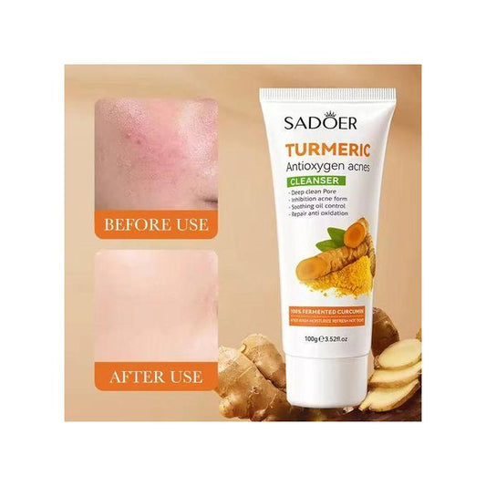 Turmeric Cleanser Anti Acnes Facial Cleanser, Tumeric Deep Cleansing Oil Control Cleanser