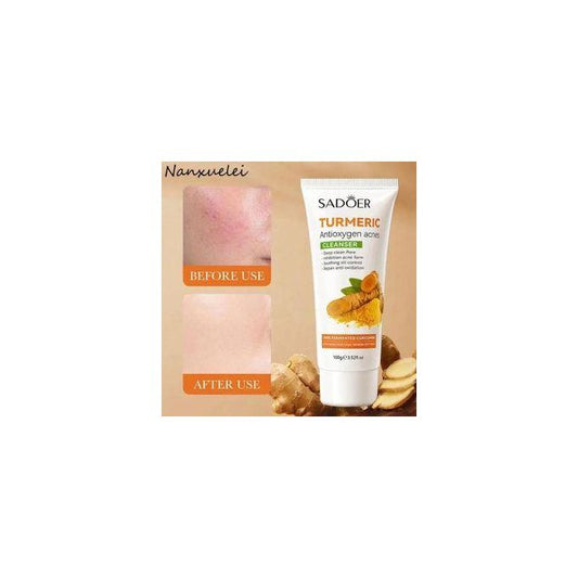 Turmeric Cleanser, Antioxygen Acnes Tumeric Cleanser