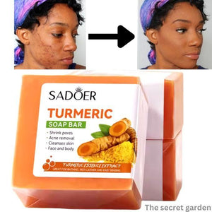 Turmeric Soap 1pc , Hydrating Tumeric Soap -Clears Acne, Shrink Pores, Cleanse Skin