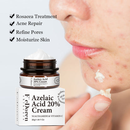 Azelaic Acid 20% Whitening Fades Acne Cream Freckle Remove Melasma Dark Pigment Spots Melanin Alpha Arbutin Face Cream Skin Care
